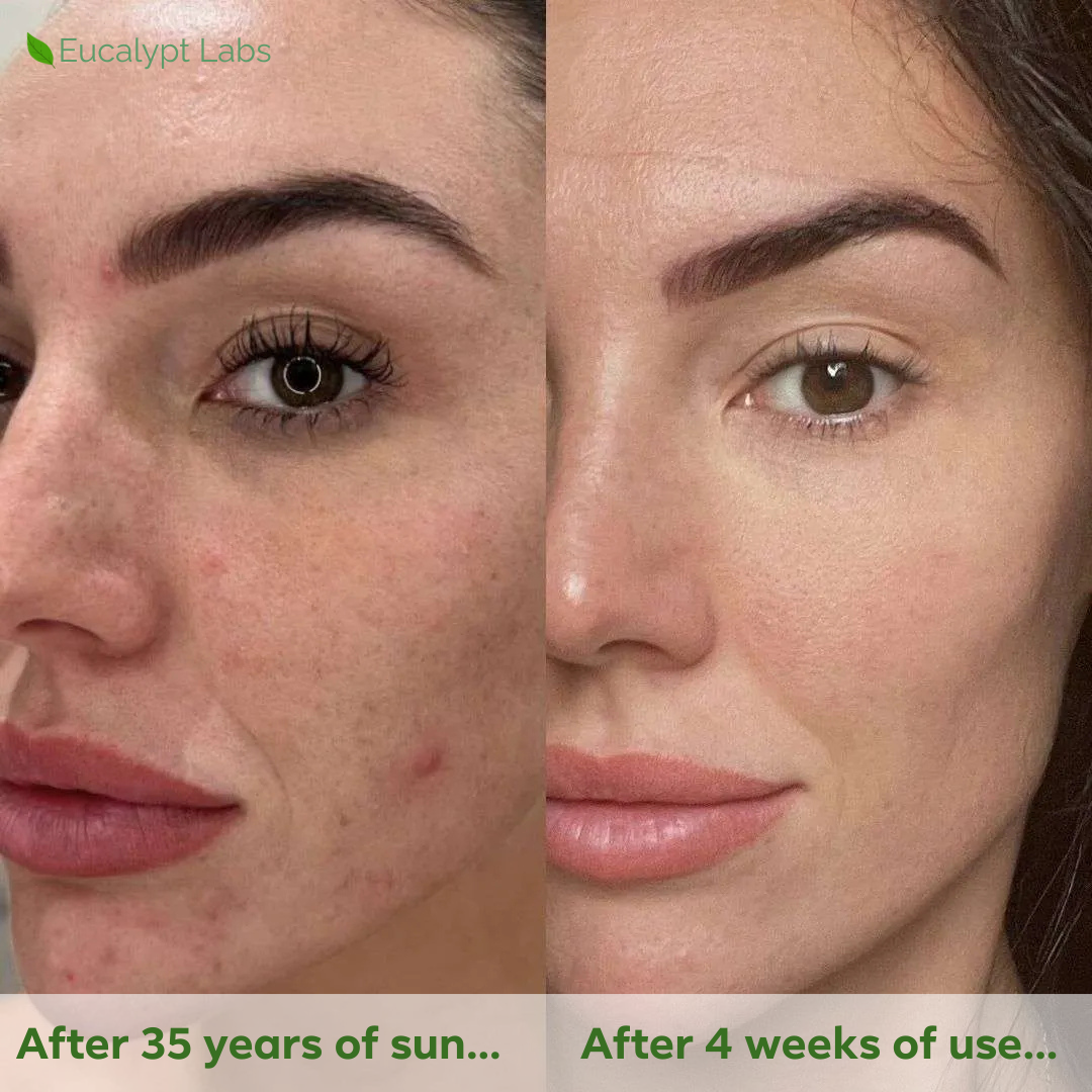 Spotless Serum (Clearer, Balanced Skin)